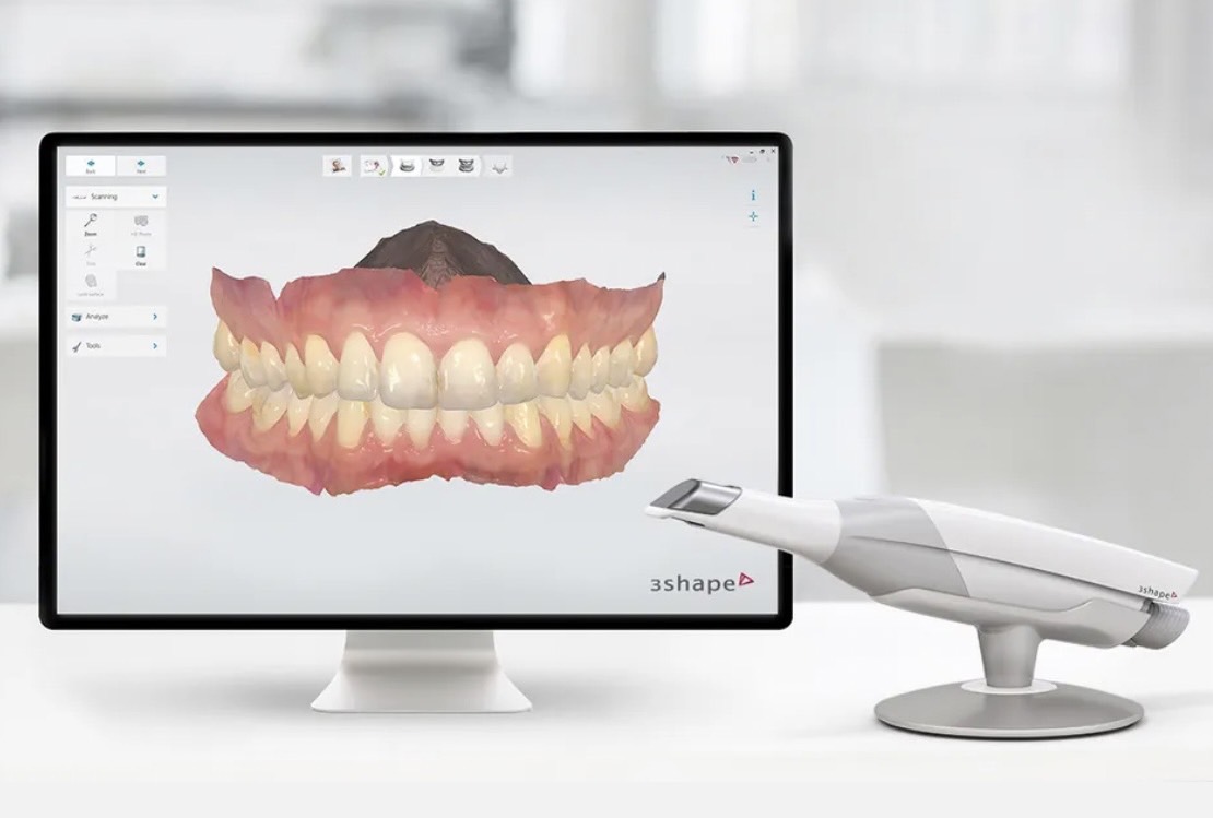 新竹恩澄牙醫使用數位口掃機能快速建立精準且完整的牙齒模型，您不用再忍受傳統印模材料的不適感，誤差也更小